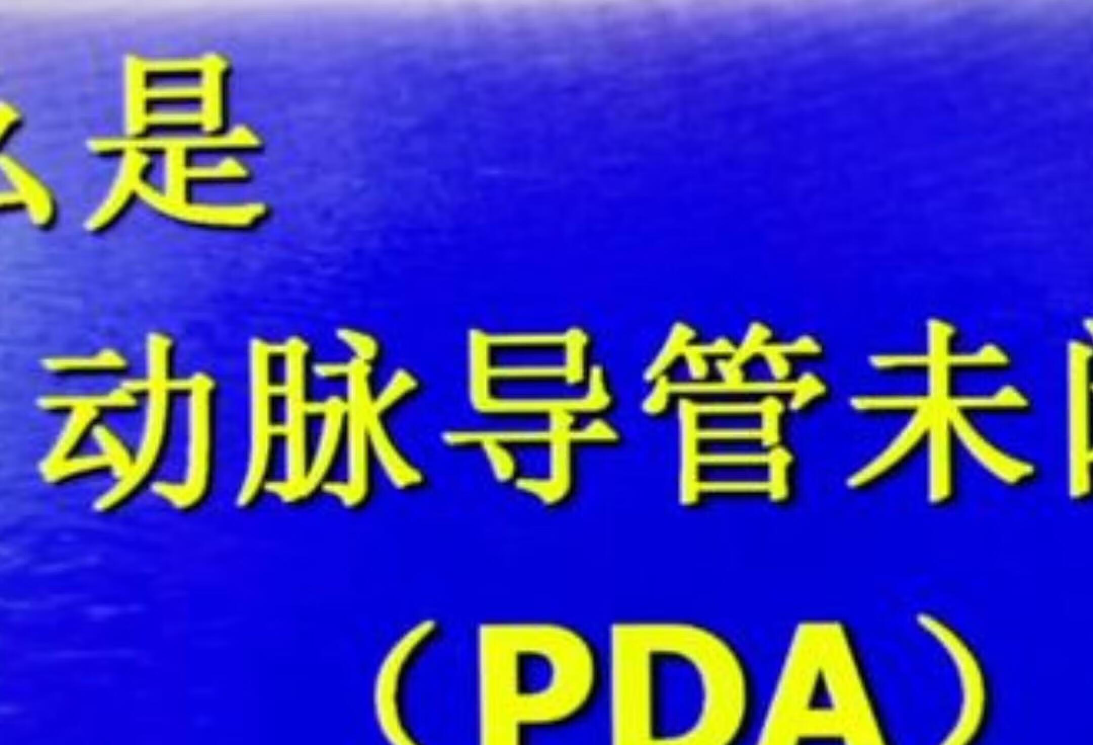 医学科普 心脏科普（二十七）什么是动脉导管未闭？ 