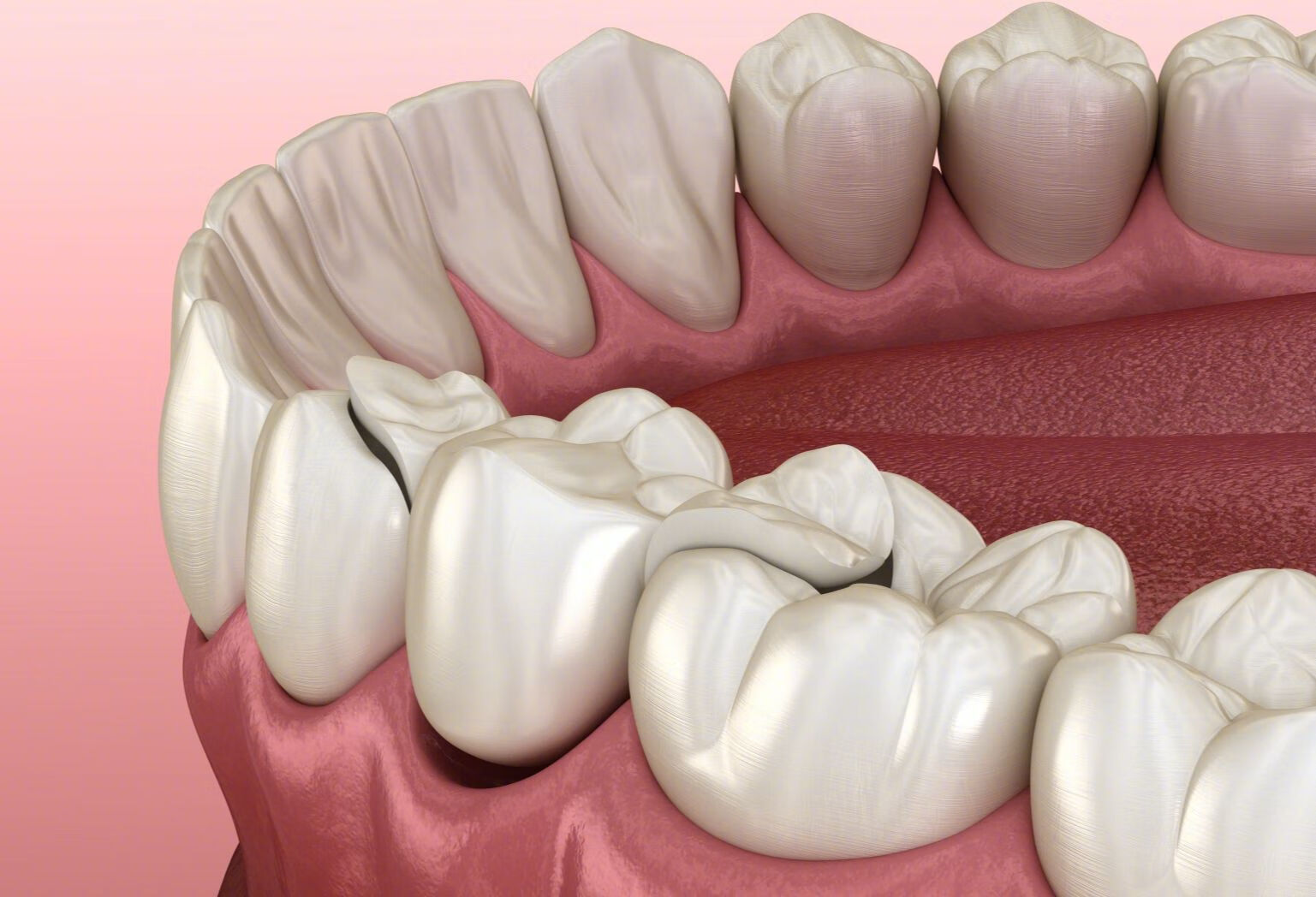 医生设计牙齿矫正方案需要考虑哪些因素？