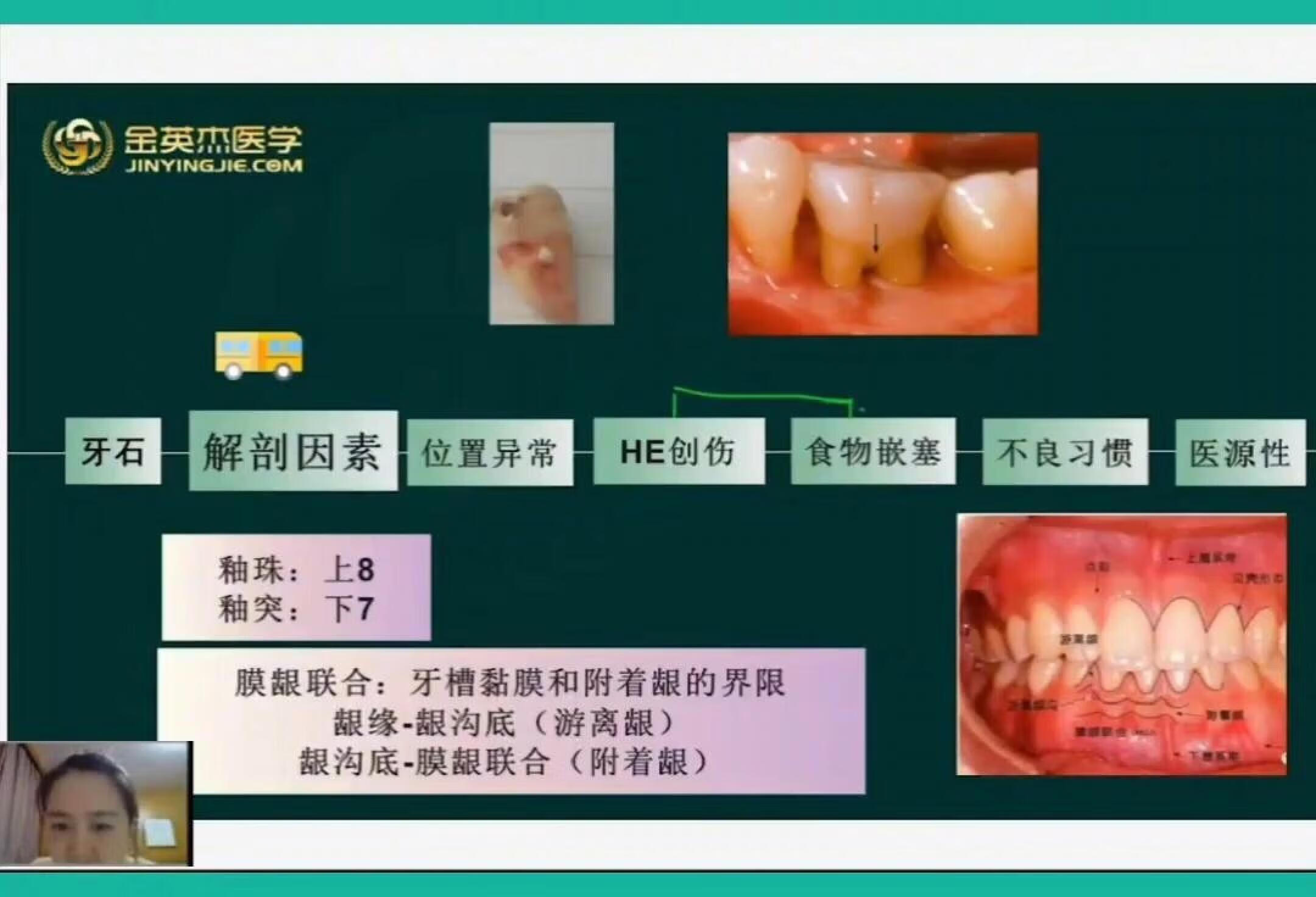 口腔助理执业医师口内牙周龈炎的促进因素