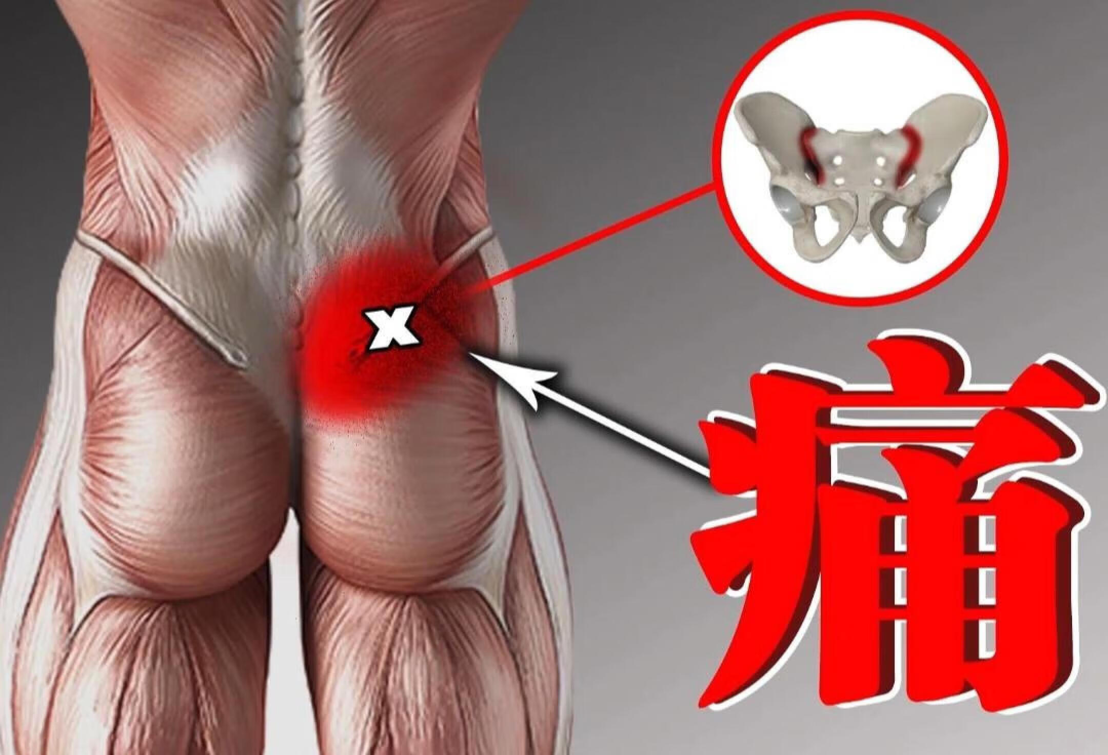 骶髂关节疼痛 康复训练