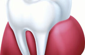 牙龈出血是口腔溃疡吗