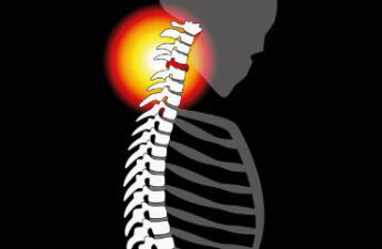 诱发电位在脊柱外科中的应用