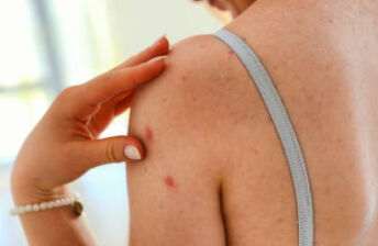 孕妇感染水痘的危害有哪些？