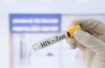 艾滋病的各种检测办法，最早检测时间，漏检率