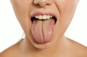 舌苔黄厚腻的原因
