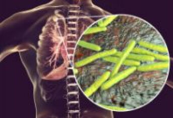 结核病会导致肺部形成空洞吗