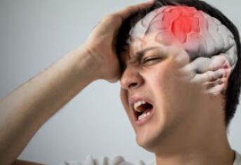 血管神经性头痛应该怎么缓解