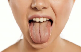 舌头厚是怎么回事 