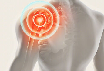 你的康复治疗达标了么----康复治疗≠康复锻炼—肩袖损伤篇