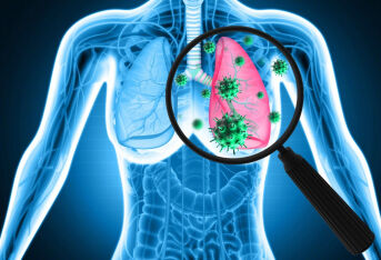 肺寄生虫病患者日常有什么需要注意的？