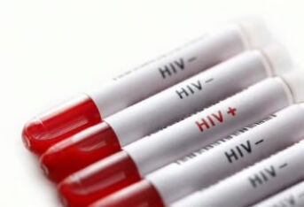 艾滋病常见问题汇总