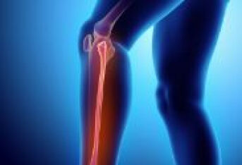 膝关节积液疼痛怎么办？