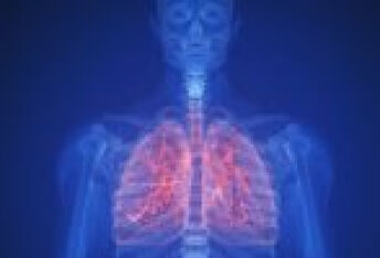 肺癌晚期如何治疗？