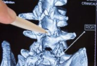 盆腔炎会导致腰椎疼痛的出现吗？