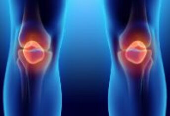 膝关节骨性关节炎的阶梯治疗