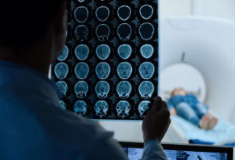 脑内海绵状血管瘤的治疗方案如何选择？