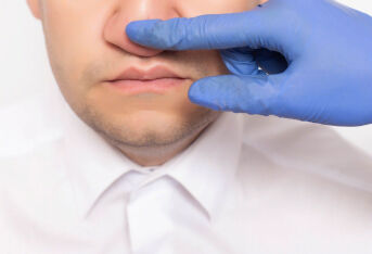 鼻中隔偏曲的症状表现有哪些？