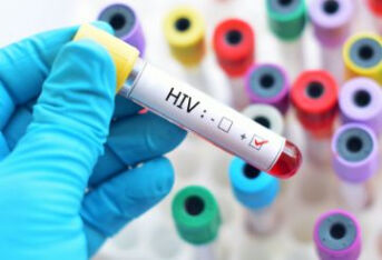艾滋病检测到底是检测什么？
