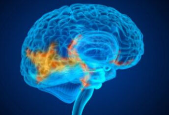临床上脑动脉瘤的治愈率是多少？