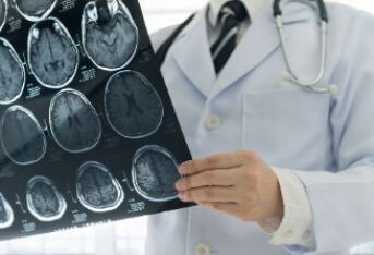 什么是脑梗塞二级预防