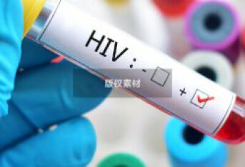 25岁女子剧烈呕吐，抽血显示感染了艾滋病