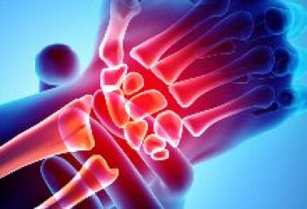 类风湿关节炎导致手脚变形的原因
