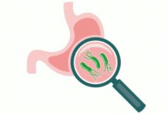 幽门螺杆菌的检查、治疗和预防（2）