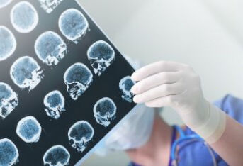 脑膜瘤的临床症状及手术指征