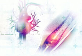 主动脉覆膜支架植入术后常见并发症（一）