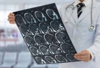 脑血栓形成和脑栓塞有哪些区别