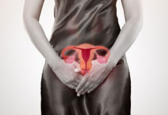 中医体质与子宫内膜异位症相关性的研究