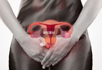 晚期卵巢癌主要表现是什么？如何提前发现？