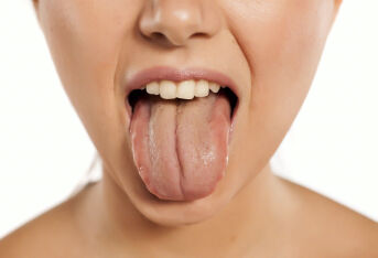 舌头裂了疼吃什么药？