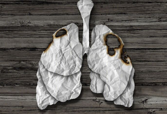 什么是肺癌相关性咳嗽？与慢性咳嗽有什么区别？