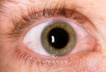 视网膜脱落术后会有什么后遗症