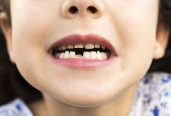 儿童蛀牙烂空了一定要拔吗。