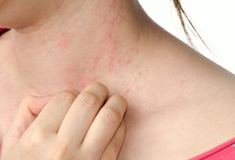 皮肤疾病知多少——痤疮、湿疹、HPV