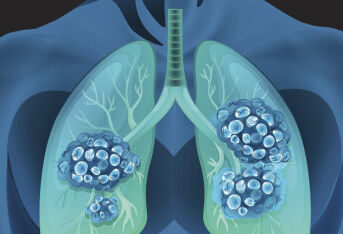 肺结节考虑恶性不是单纯做增强CT的事