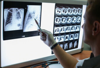 刘懿博士说肺癌（六九五四）肺磨玻璃结节复查CT要算大帐，别算小账