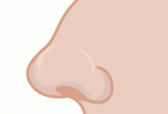 鼻溃疡应该怎么治疗？