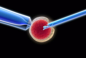 试管婴儿：了解体外受精（IVF）的过程、优点和挑战