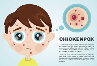 患上荨麻疹后有哪些日常禁忌呢?