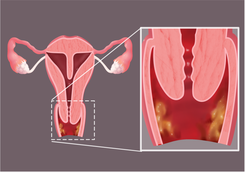 阴道 女性生殖器结构懂多少❓❓看图就知道阴道和子宫的距离很近，也 ...