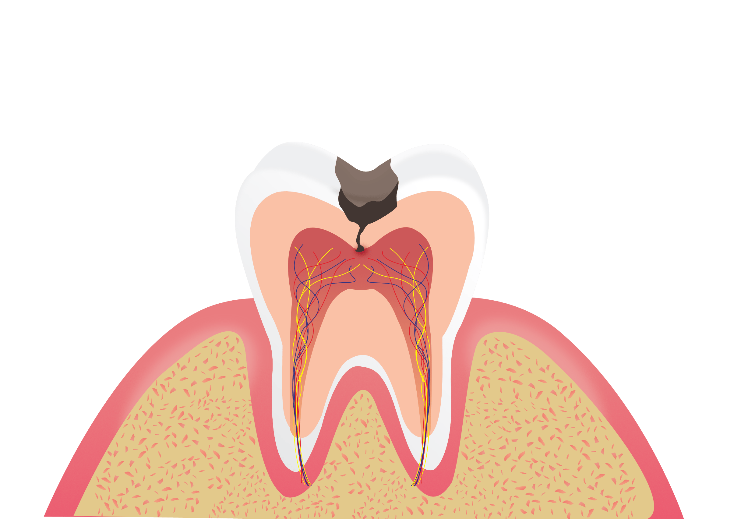 龋齿常识-京东健康