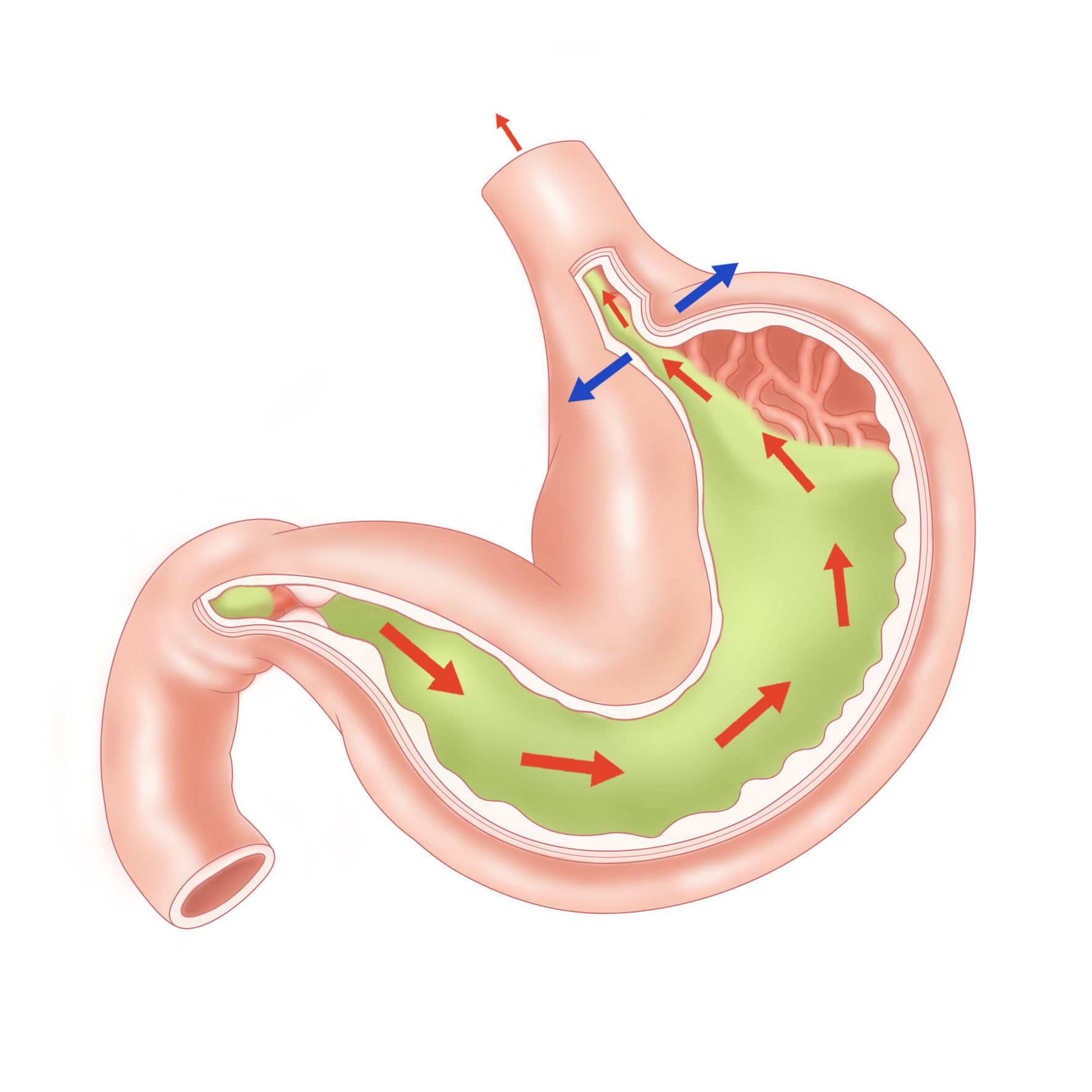 喝粥养胃,保胃养胃,哪些人不宜喝粥,喝粥能养胃吗