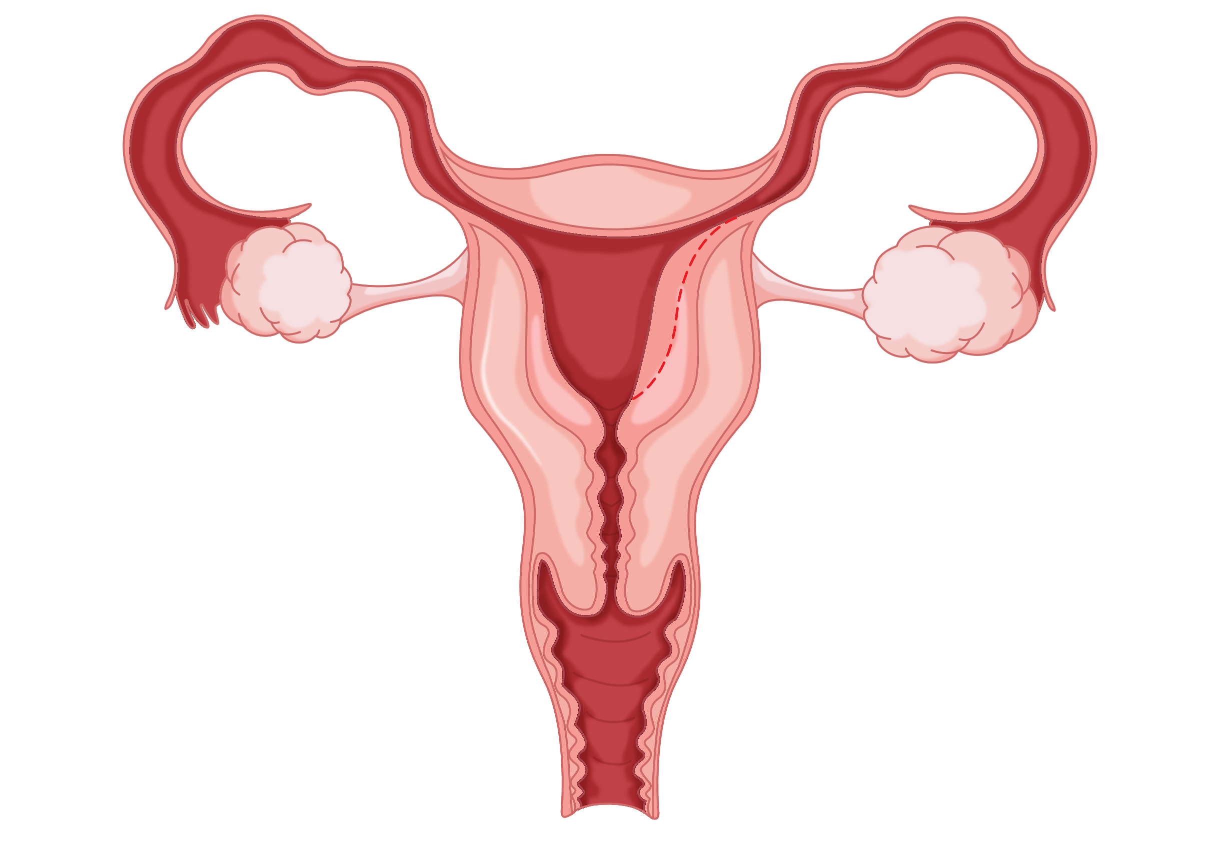 TAA Medical统恩优巢蓓春专家诠释，卵巢储备功能减退的原因和表现-TAA Medical统恩医学
