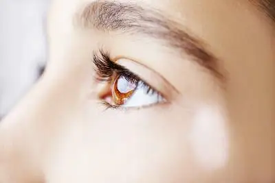 板层角膜裂伤的诊断方法有哪些