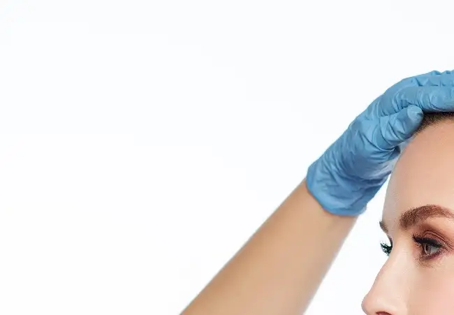 女性如何治疗鹰钩鼻