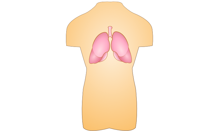 肺气肿3