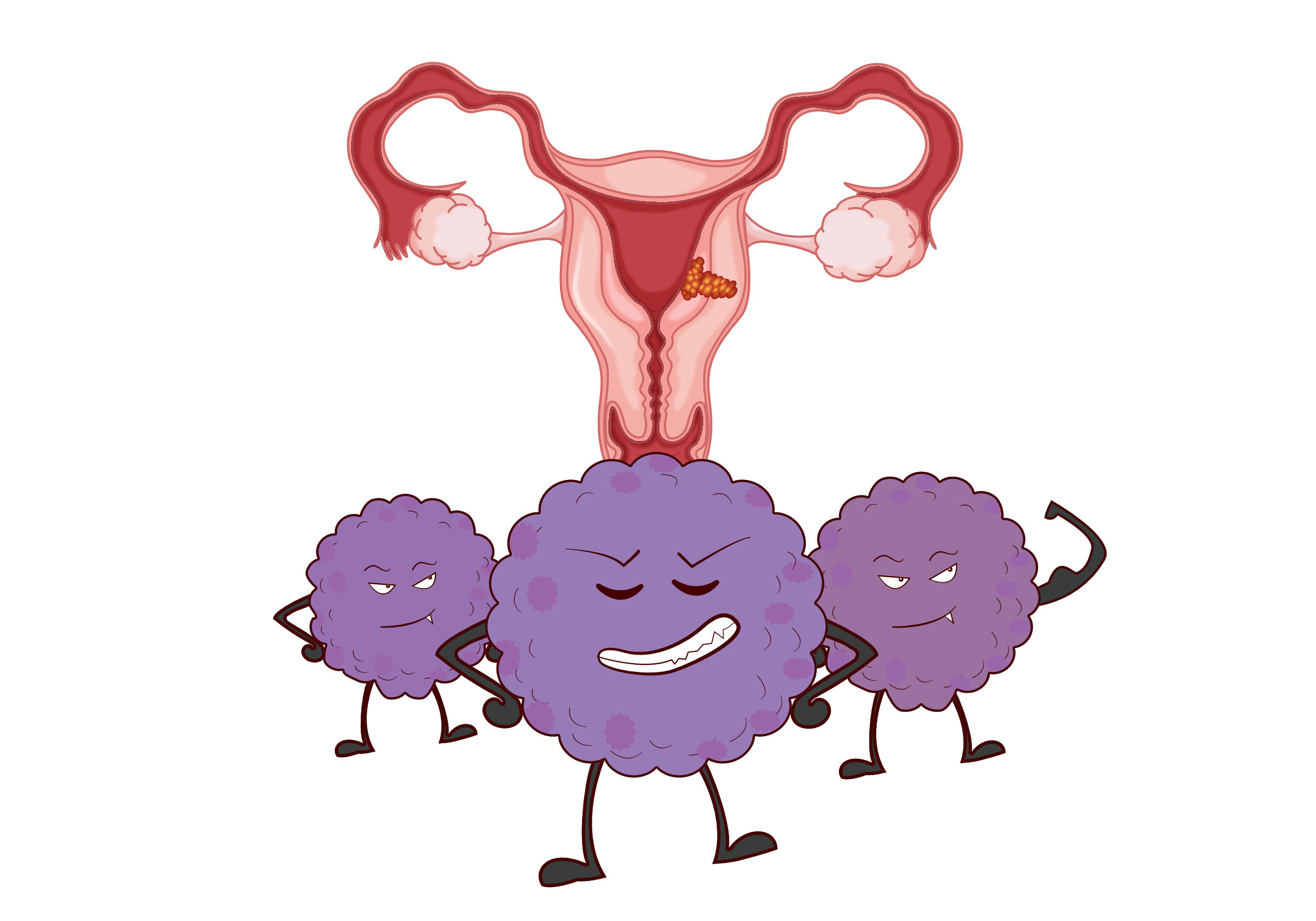 子宫内膜异位症对IVF结局的影响 - 知乎